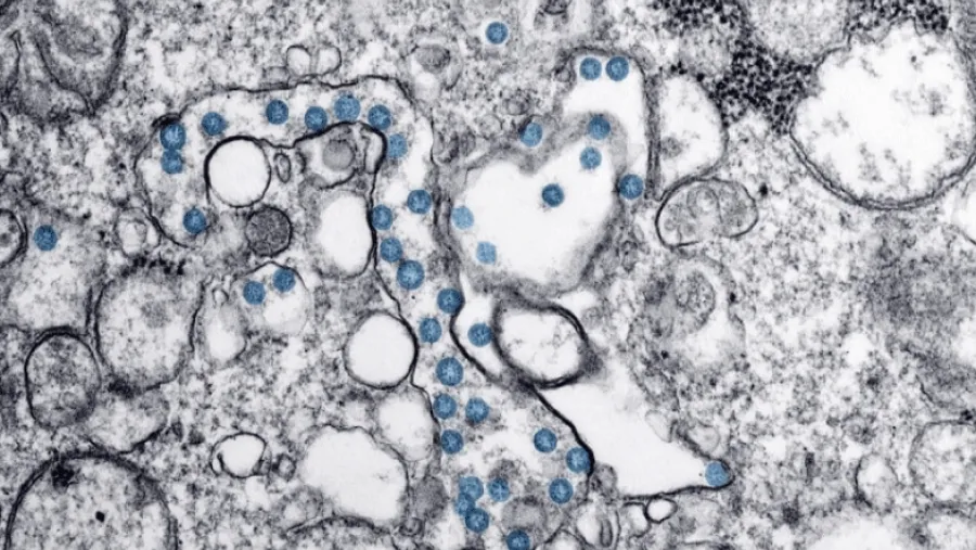 Coronavirus. Coronavirus.