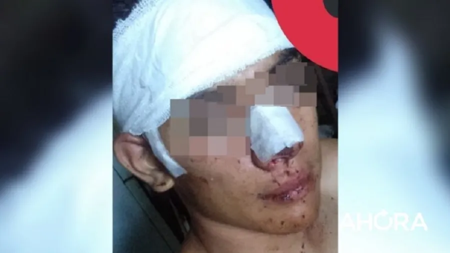 Joven golpeado Joven golpeado