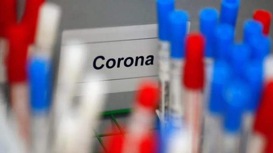 coronavirus laboratorio