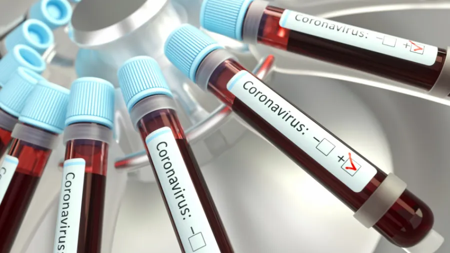 coronavirus laboratorio coronavirus laboratorio