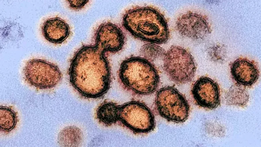 coronavirus coronavirus