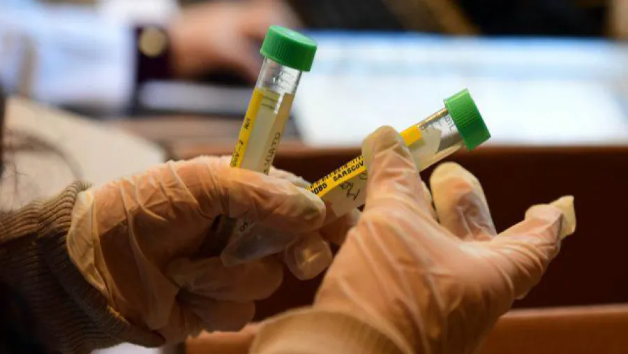 coronavirus laboratorio coronavirus laboratorio