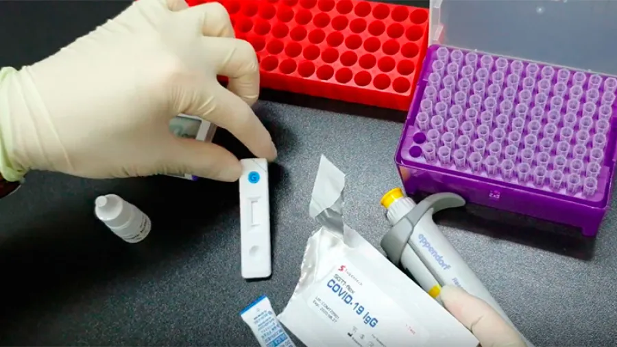 coronavirus test coronavirus test