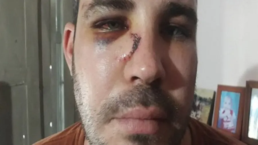 joven denuncia golpiza policial joven denuncia golpiza policial