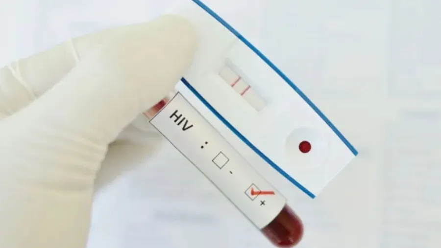 HIV test HIV test