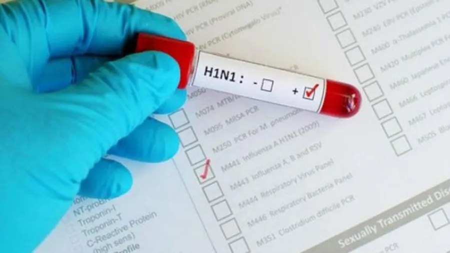 H1N1 H1N1