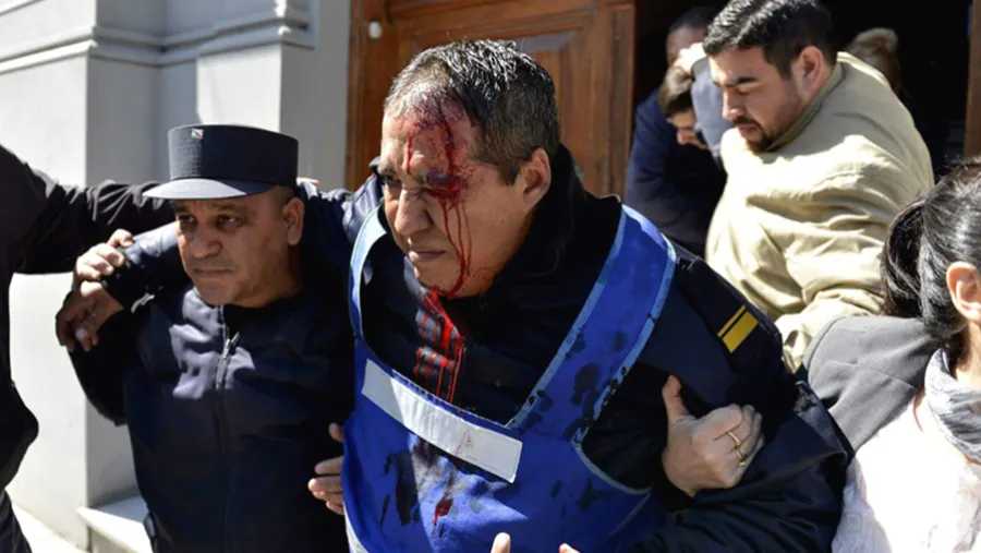 Walter Velázquez sufrió pérdida del 45 por ciento de la capacidad auditiva, daños neurológicos y pérdida de memoria a corto plazo, que lo obligaron a tramitar su retiro de la fuerza policial, por la agresión del tractorazo del 3 de septiembre de 2015. Walter Velázquez sufrió pérdida del 45 por ciento de la capacidad auditiva, daños neurológicos y pérdida de memoria a corto plazo, que lo obligaron a tramitar su retiro de la fuerza policial, por la agresión del tractorazo del 3 de septiembre de 2015.